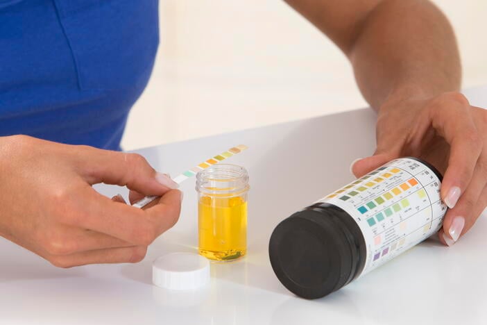 Why too many women are prescribed antibiotics for UTIs they don't have