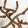 Black fungus thriving in the midst of Ireland's whiskey boom