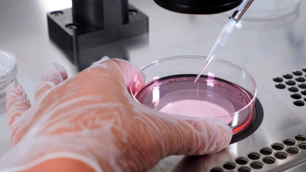 High Fertility Costs Push Americans Abroad for IVF Treatment