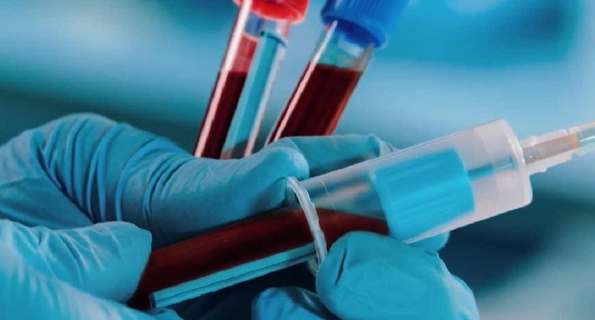 UCSD granted $11.3M to develop ‘smart' blood cells to improve military