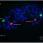 Researchers identify the world's first cell line with the KMT2A::SEPTIN6 fusion gene