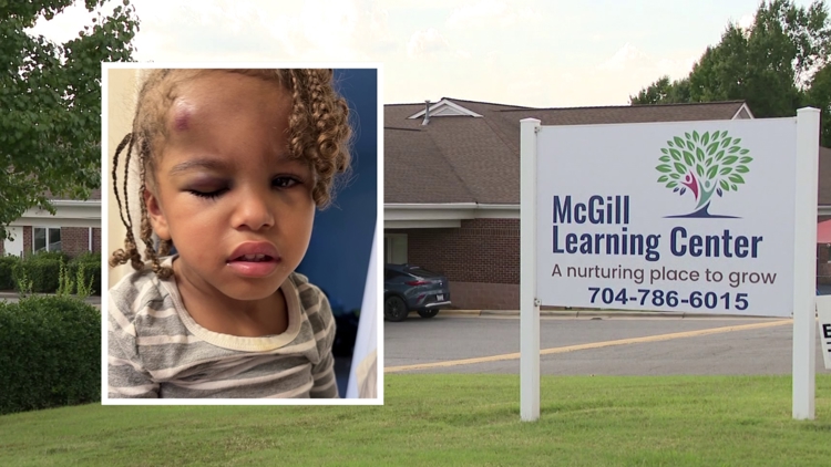 Previous state violations at Concord daycare raise questions on safety after 3-year-old came home with swollen face