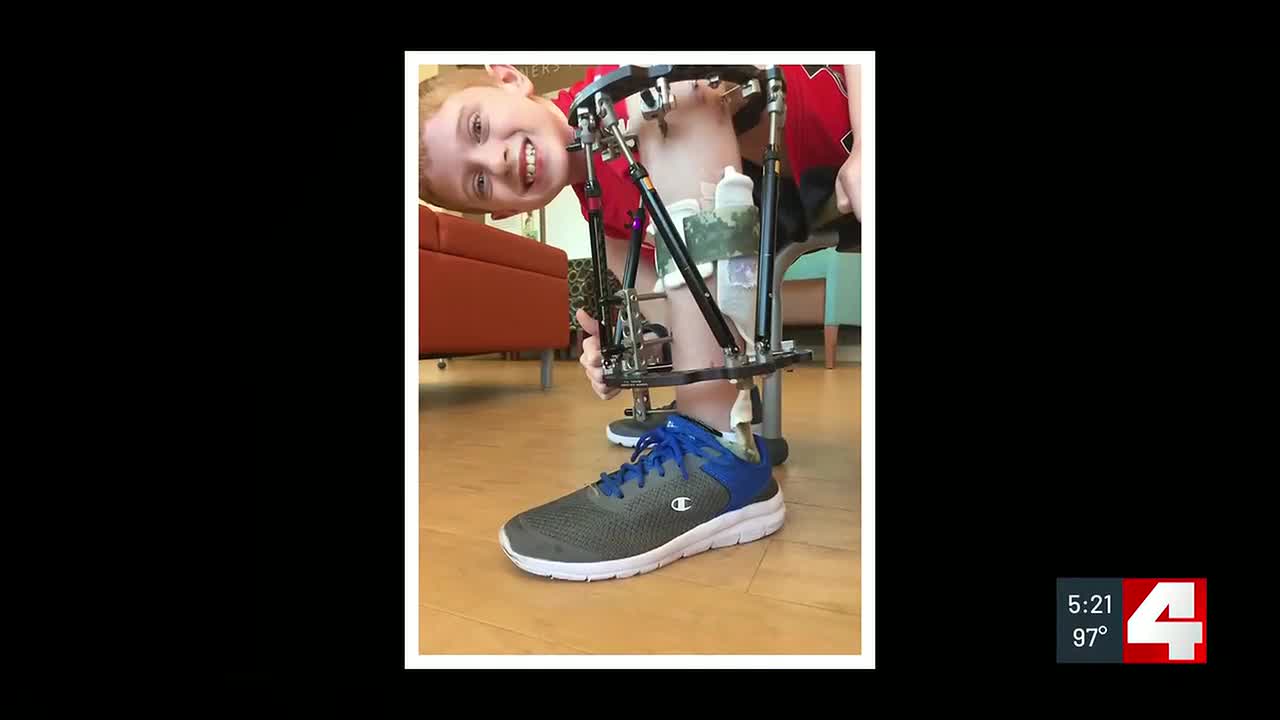 St. Louis hospital saves Nebraska boy’s leg from amputation, inspiring medical career