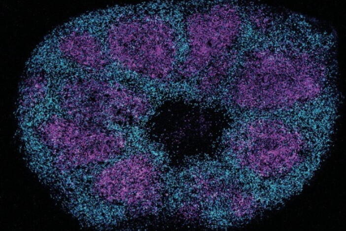 Scientists map key protein interactions linked with profound autism