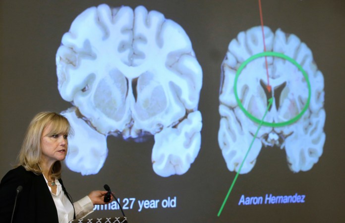One in four dead football players had CTE. Why are we still flying blind?