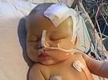 Days-old baby diagnosed with brain tumour after doctors spotted a fingernail infection