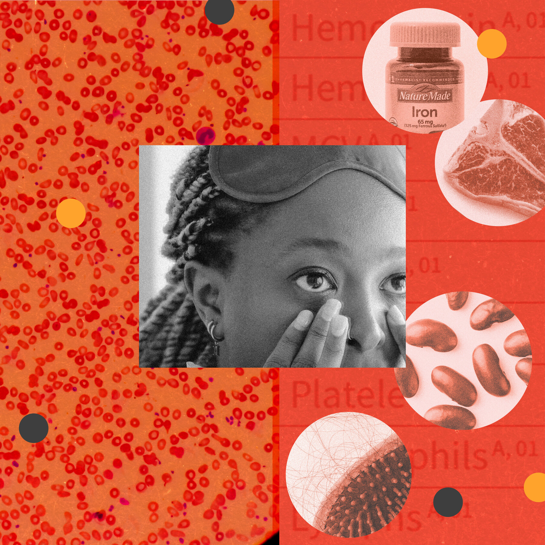Does ‘Ferritin Face’ Mean You Have an Iron Deficiency? Here’s How to Tell.