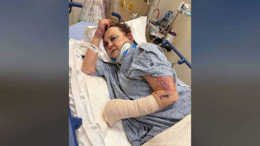 Southern California grandmother violently beaten with baseball bat by man she tried to help