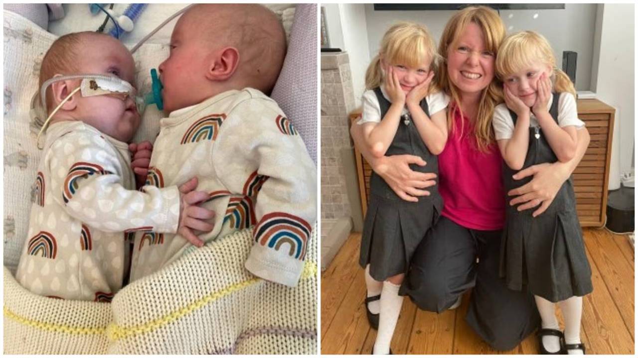 Twins given under 10% survival chance now prepare for first day of school