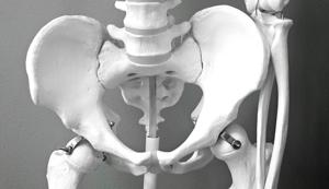 Can cancer drugs treat osteoporosis and midlife weight gain?