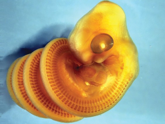 Why Snake Embryos Form in Spirals
