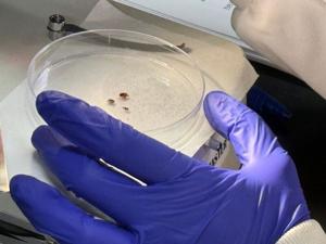 Devil's Lake State Park ranks among the worst for tick-borne illness