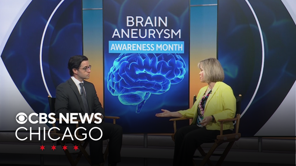 Brain aneurysm awareness with Dr. William Ares