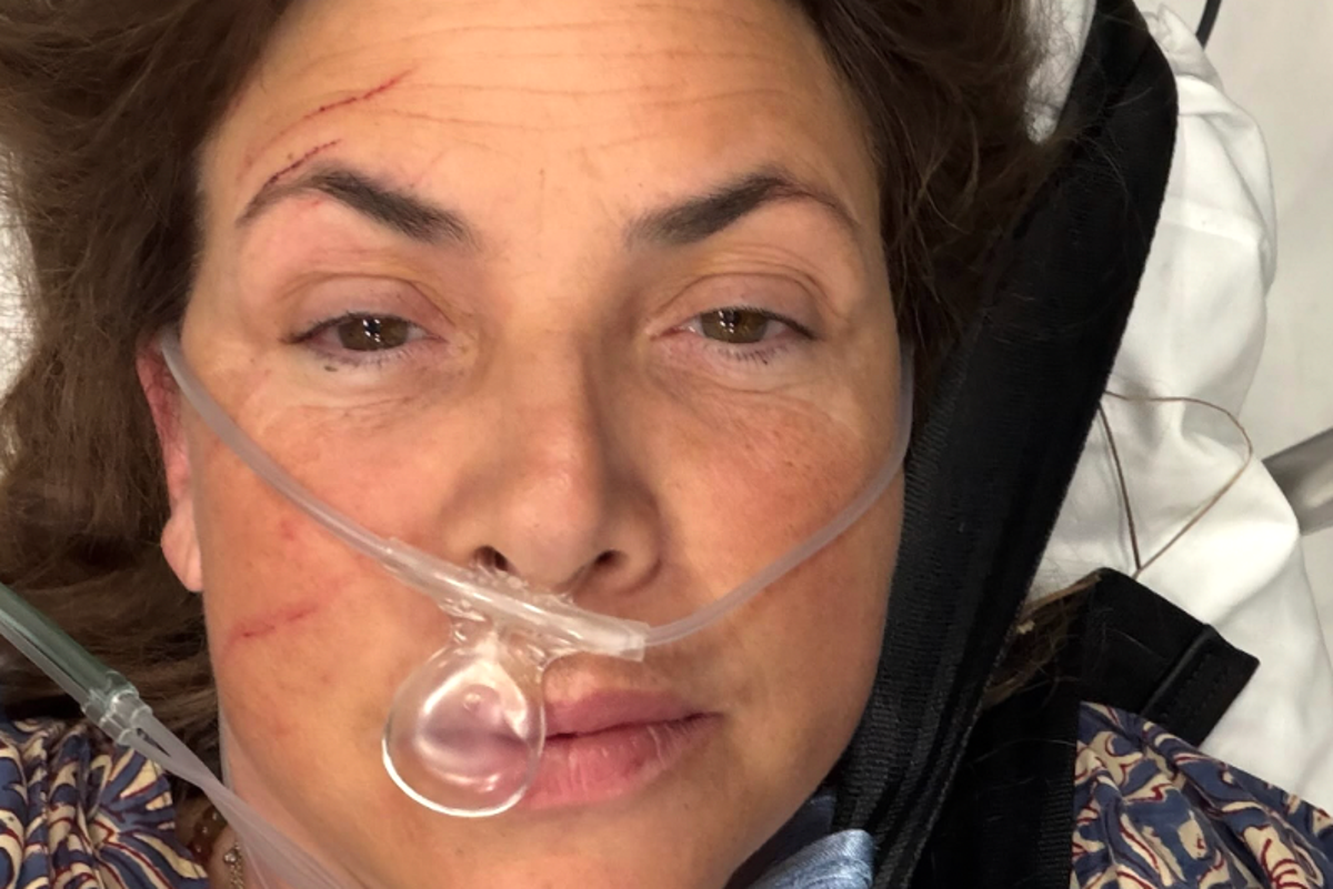 Kirstie Allsopp shares photos of injured leg after horror fall: ‘Like I’ve been bitten by a shark’