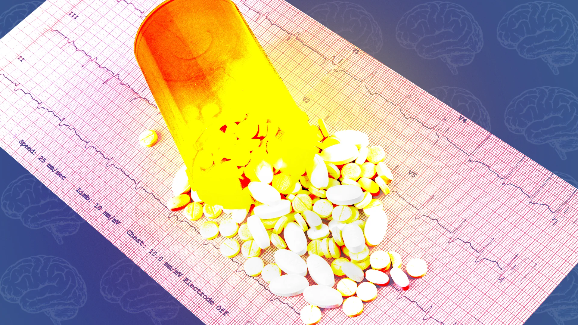 Could a Common Cholesterol Drug Lower Your Dementia Risk? A 130,000-Person Study Finds a Link