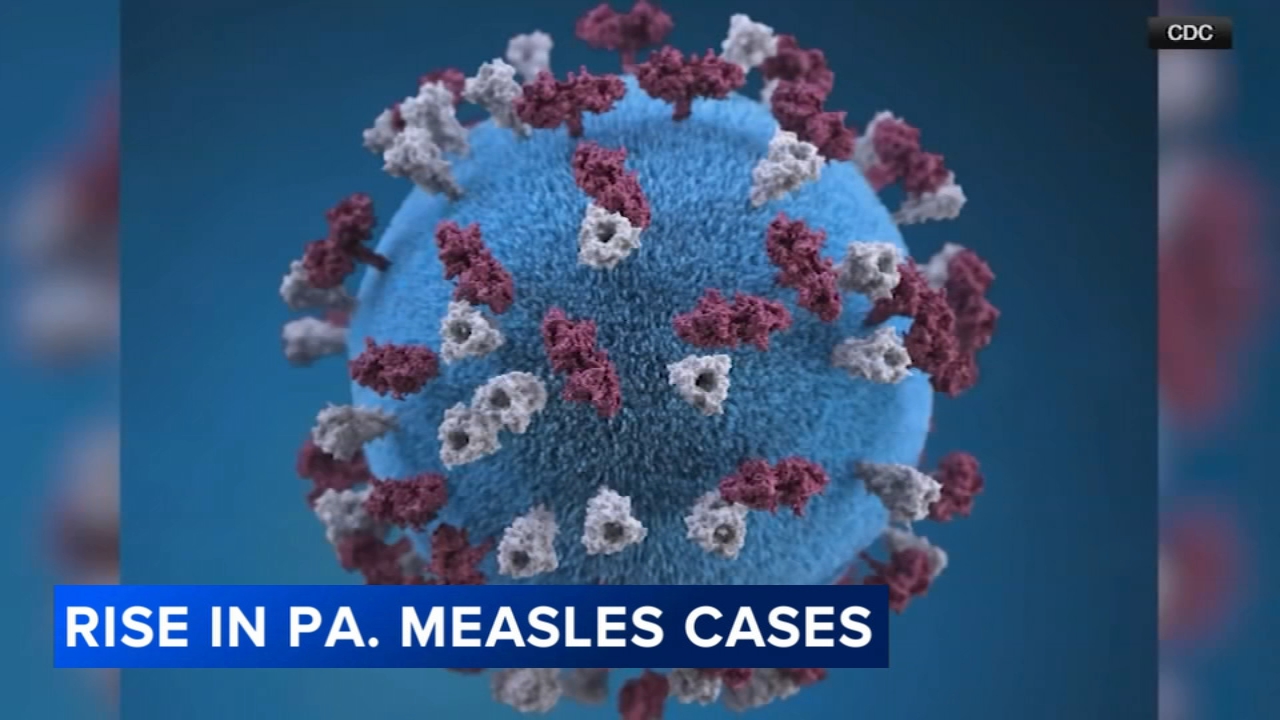 Chester County measles cases rise as state reports 676 infections