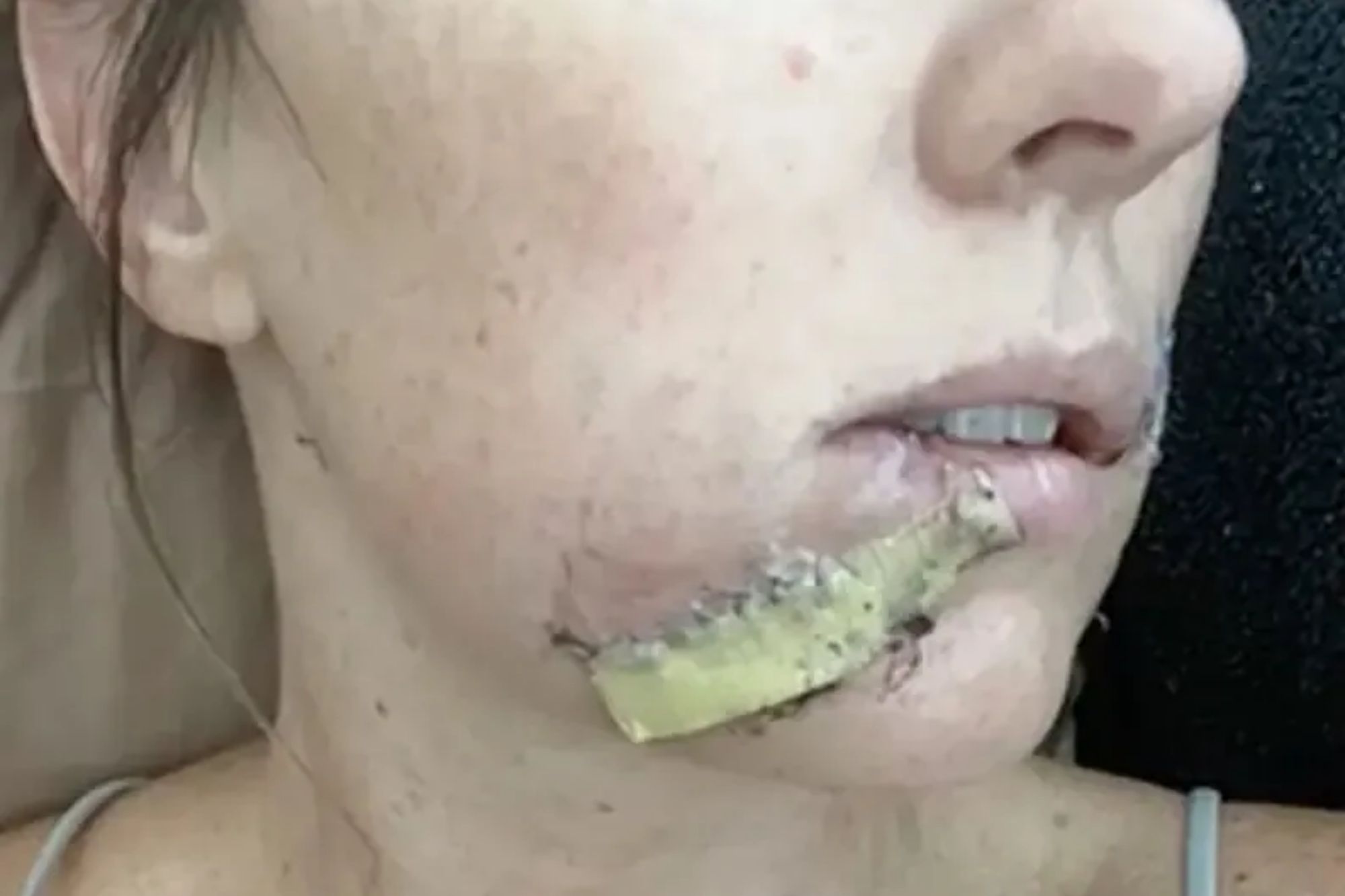Mum fights off vicious coyote with a flip-flop after it attacks four-year-old daughter then bites her face