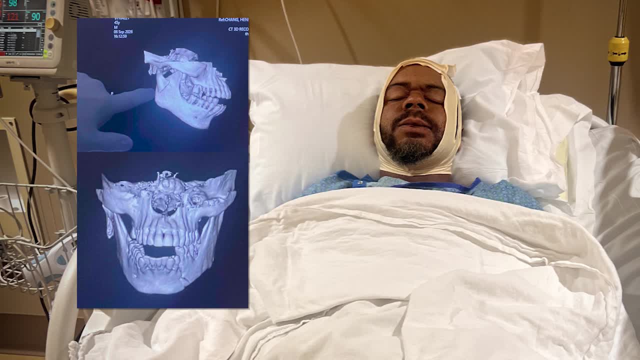 Man’s fiancée says their lives are forever changed after he was assaulted at the Minnesota State Fair