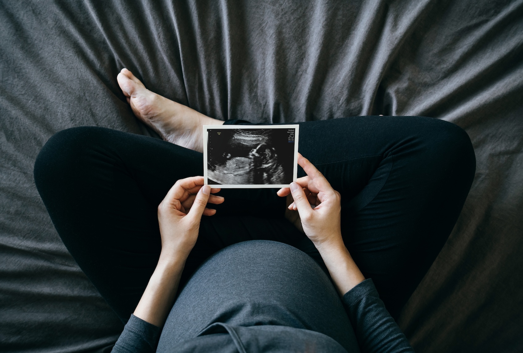 Ectopic pregnancy deaths have nearly doubled. It’s worse in states with abortion bans