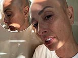 Melanie Sykes shares photos of her shaven head in glowing selfies after revealing she lost 'two thirds' of her hair due to alopecia