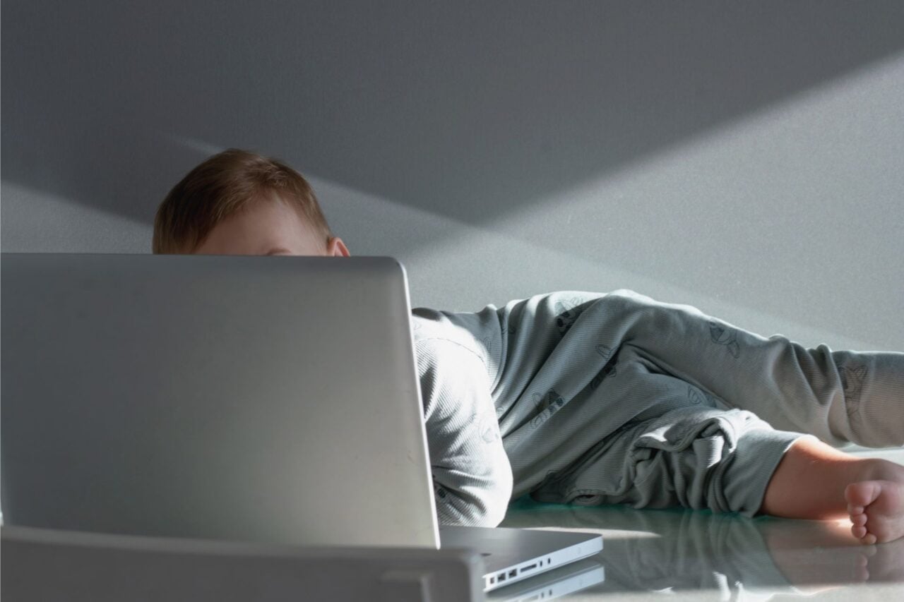 A Boy Spent 8 Hours a Day With a Laptop on His Body. He Ended Up With ‘Toasted Skin’