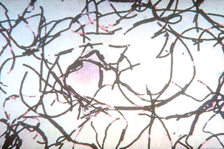 Anthrax outbreak kills more than 50 animals, infects 12 people in Zambia