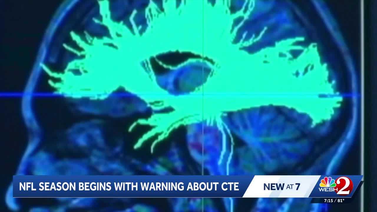 Former NFL player and neurosurgeon addresses CTE concerns and youth football safety