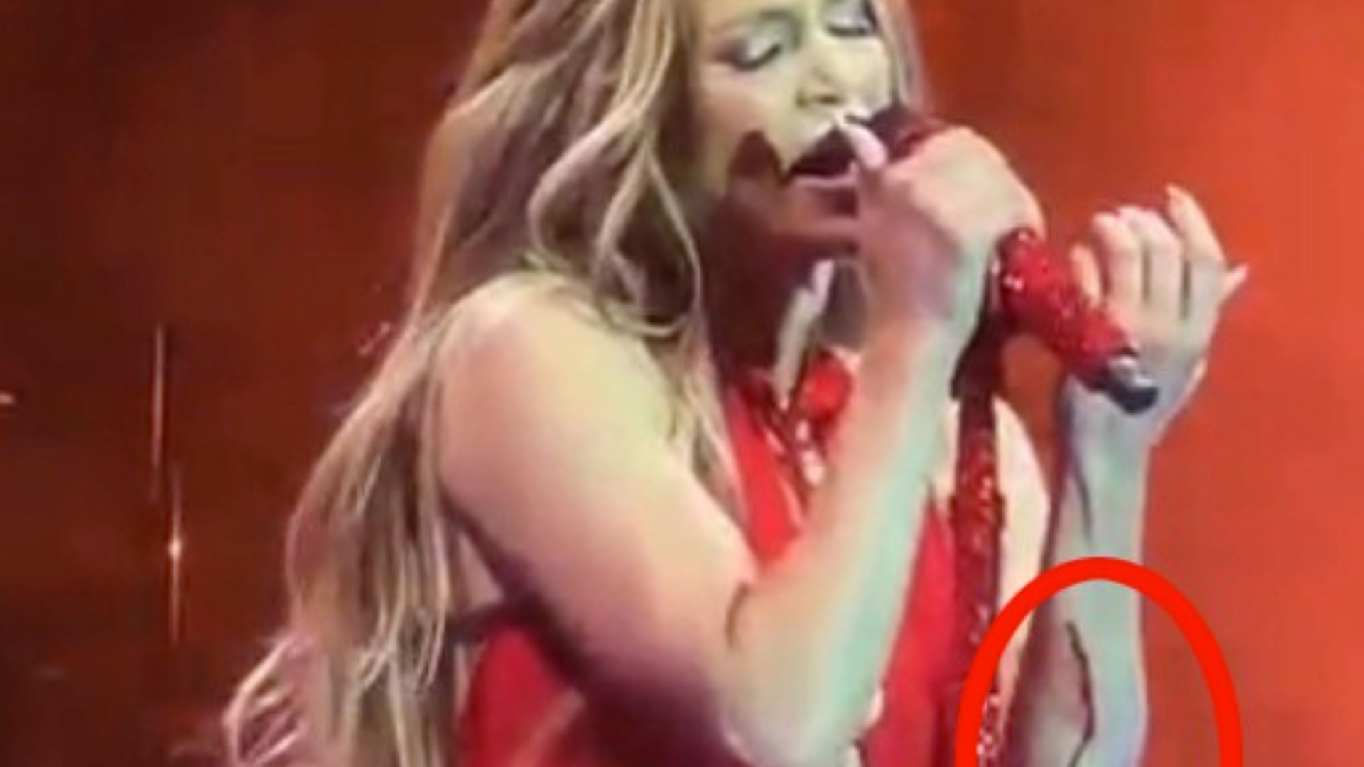 Jennifer Lopez suffers gory arm wound during live gig as blood pours from her arm