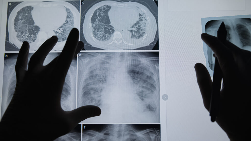 Opinion: How my cancer diagnosis changed the way I train physicians