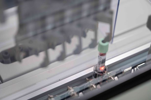 Groundbreaking blood test can spot one of deadliest forms of cancer at its earliest stages
