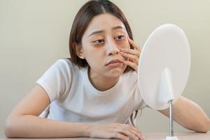 How sleep, stress, and your skin are connected