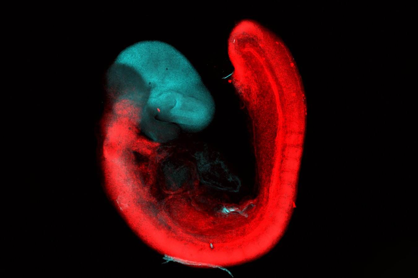 Our brain evolved from two primitive nervous systems that merged