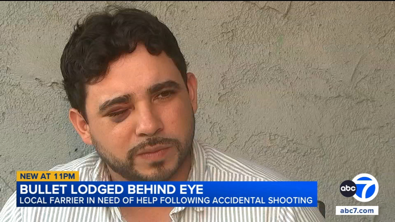 Freak accident leaves man with bullet fragment lodged behind his eye after Chatsworth shooting