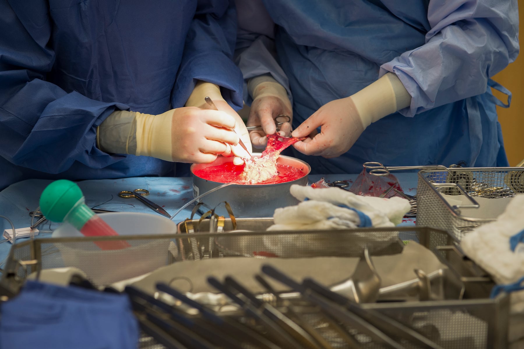 A mysterious disease is sending healthy Texas workers to the hospital