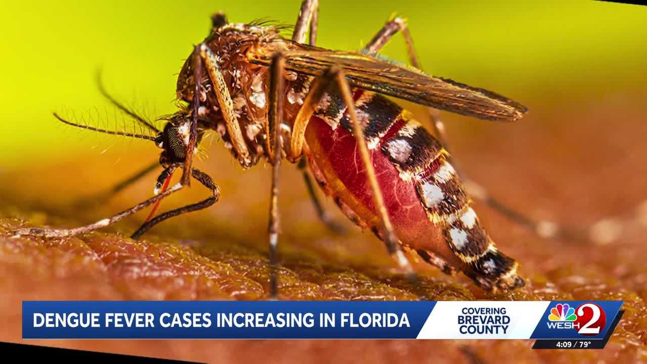 Florida leads the US in dengue fever cases as mosquito-borne illness surges