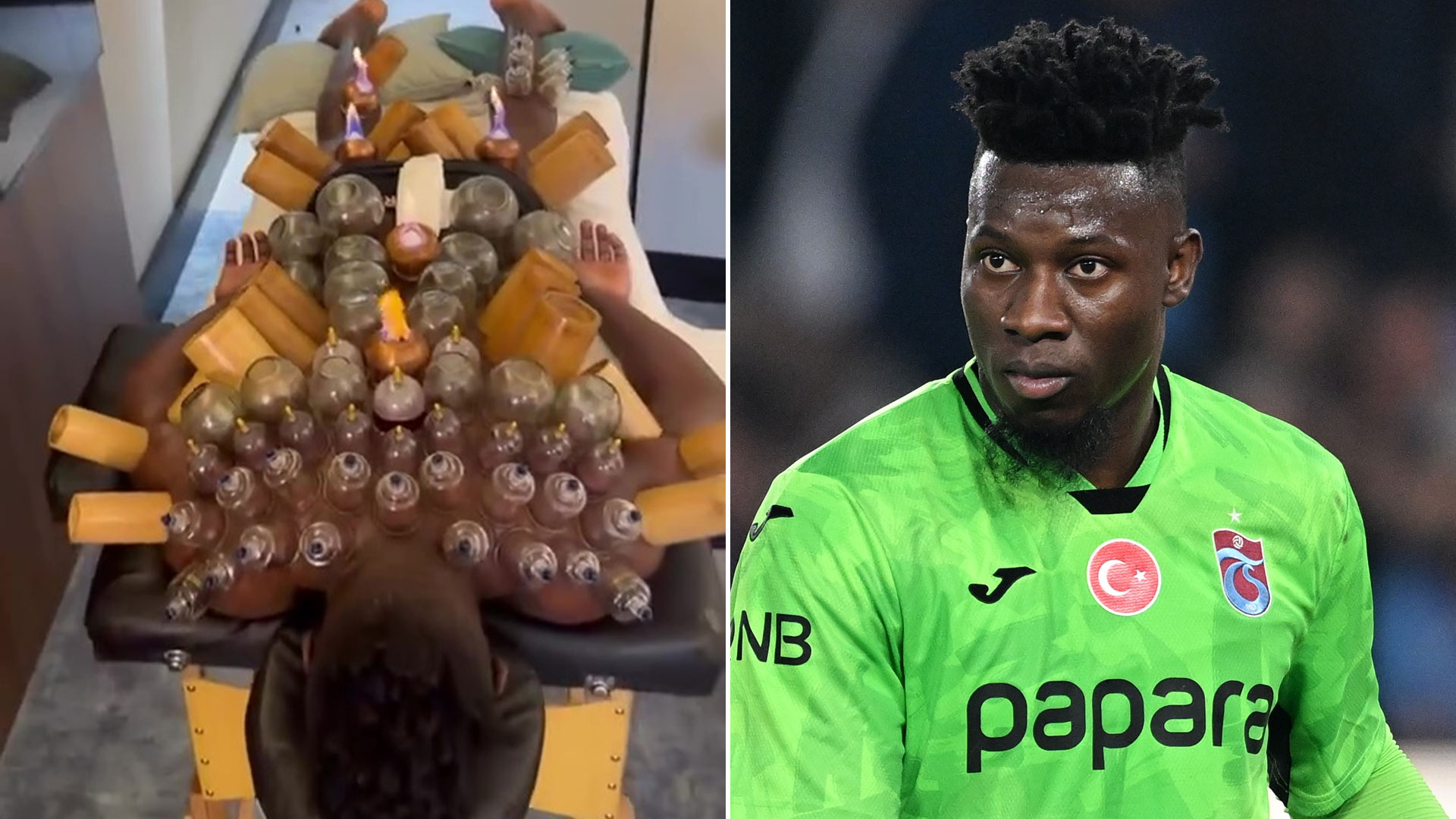 Man Utd flop Andre Onana takes bizarre cup therapy treatment to new level with FIRE as goalie covers himself head to toe