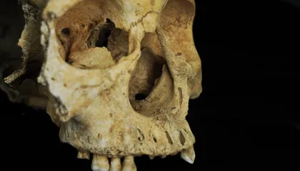 This Woman Who Lived in 14th-Century China May Have Had Her Nose Cut Off as Punishment for Theft or Adultery