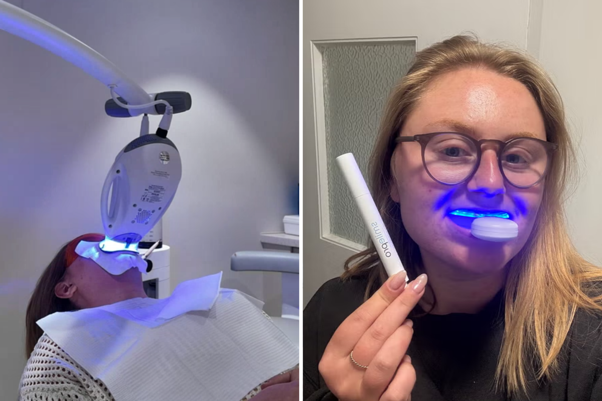 I tried Philips Zoom’s £850 teeth whitening – but an at-home kit surprised me more