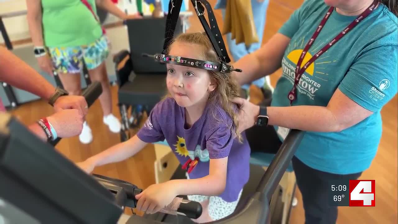 Shriners Children’s Hospital patient thrives in halo traction treatment