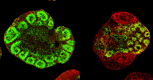 Polarized cortical organoids mimic the brain’s regional organization