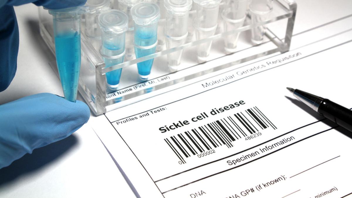Match sickle cell status, not horoscopes before marriage, say experts in Odisha