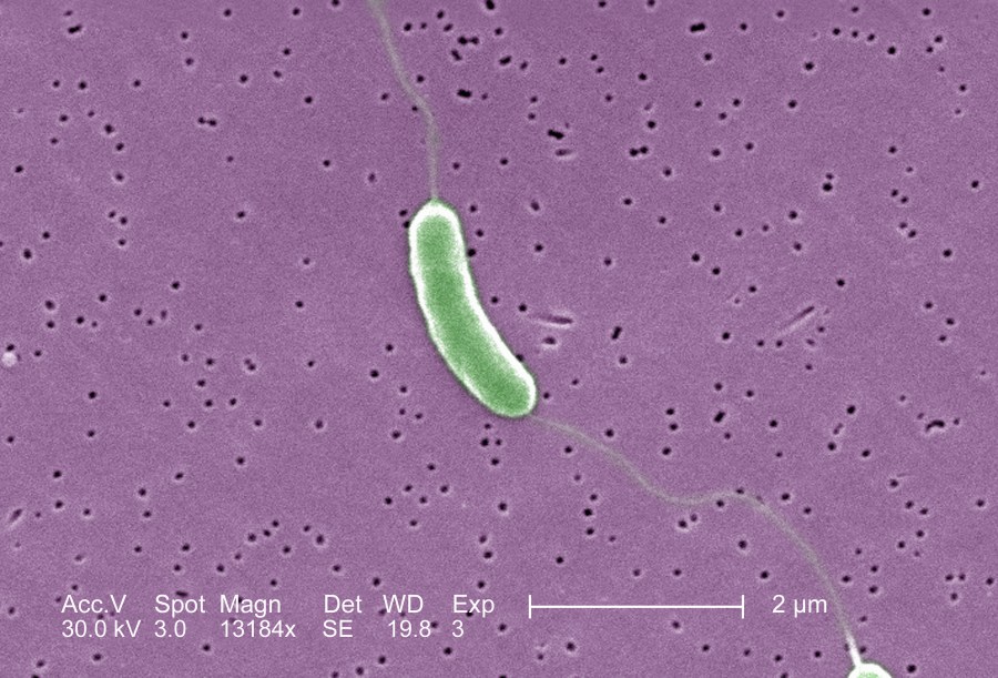 Death from Vibrio vulnificus reported in Pinellas County, 5th in Florida
