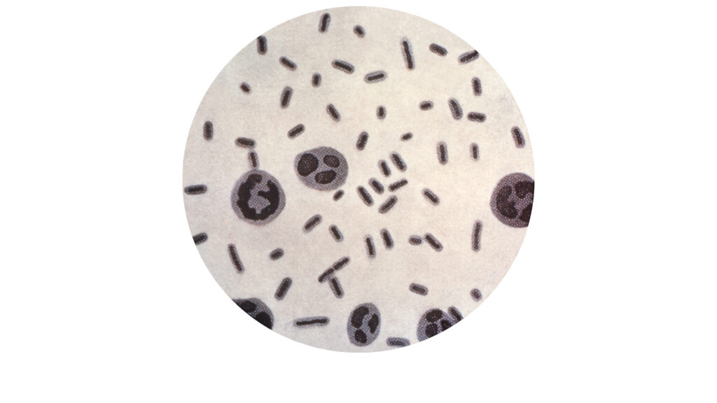 STAT+: Merck discontinues a crucial antibiotic despite concerns over superbug resistance