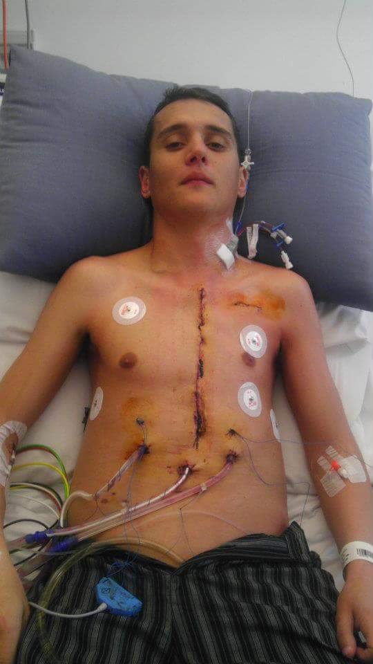 Father who survived SIX heart operations backs NHS appeal as nine die each week awaiting transplant