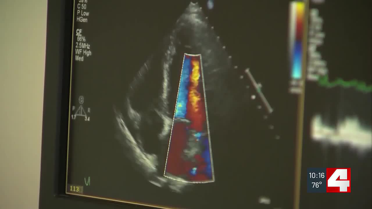 BackStoppers’ first preventative effort focuses on finding heart attack risk