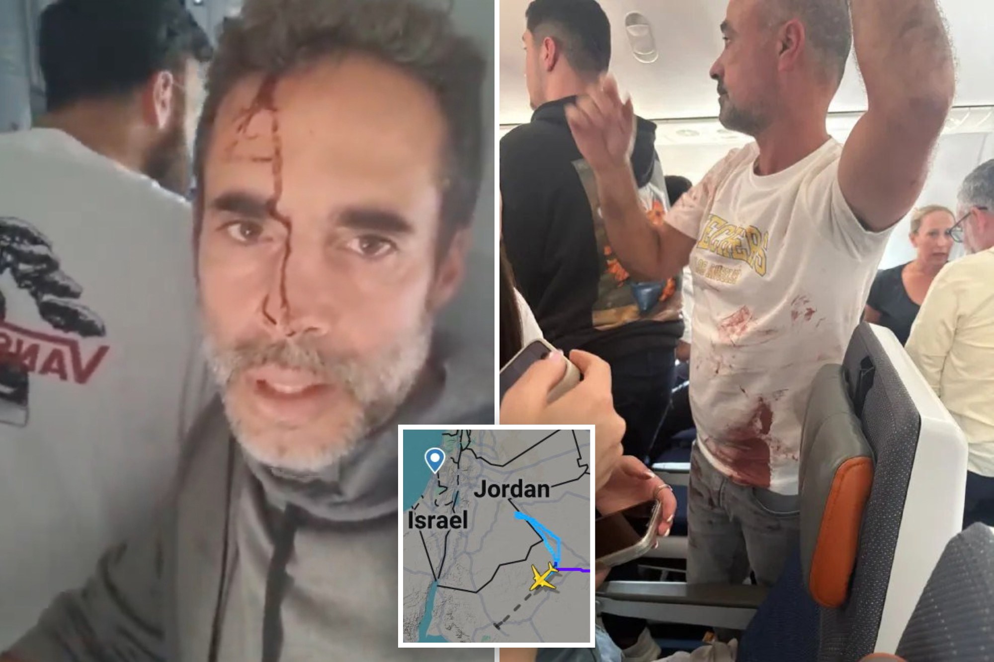 Bloodied Israel-bound jet passenger begs for help after ‘hijacking’: ‘We’ve subdued the terrorists’