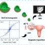 Mouse study reveals magnetic nanoparticles' potential for ectopic pregnancy diagnosis and treatment