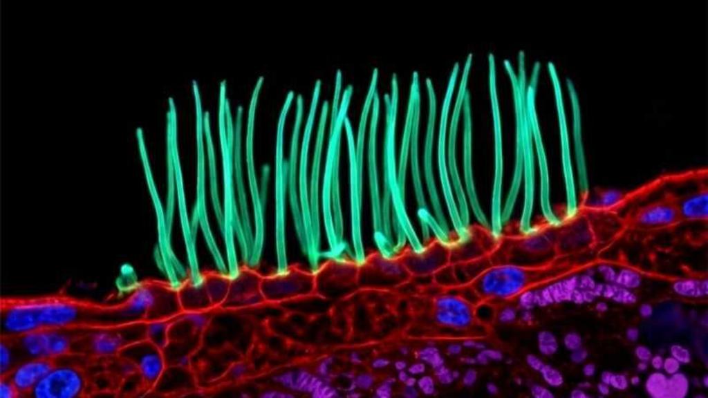 Tiny image sparks big backlash in Nikon photo contest