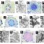 Microscopic atlas reveals how citrus Huanglongbing disease progresses through trees