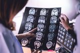 5 Recent Dementia Research Advances — From Blood Tests and Lithium to Lifestyle Changes